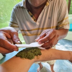 Caya Shobo natural remedy specialist applies a plant poultice to an Ayahuasca Retreat guest's elbow to treat inflammation